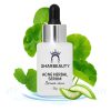 Serum cấp ẩm cho da dầu